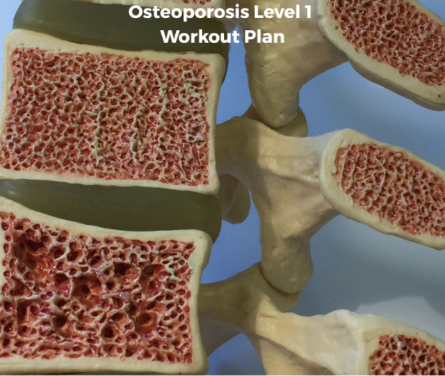Osteoporosis Level 1